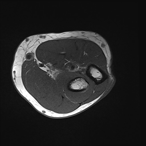 Click on the Serie image to view the images of Wieszt, Gnter